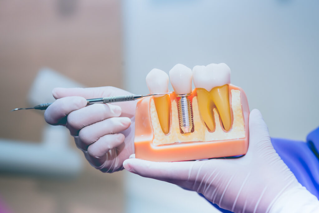 dental implants in Sudbury, MA